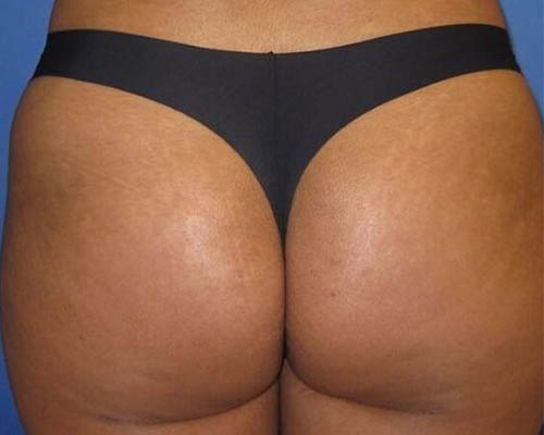 Client after the course, with individual-results disclaimer