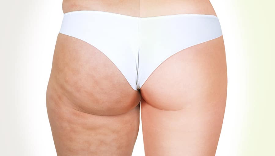 Skin-texture comparison image discussed with an individual-results disclaimer