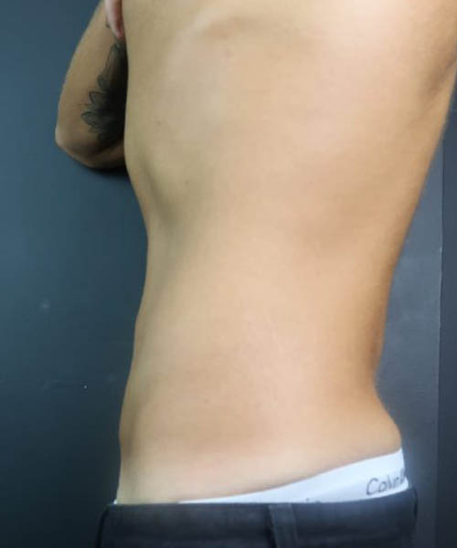 Side profile recorded after the client’s follow-up