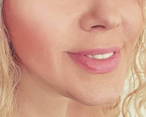 Comparable facial view at the later review