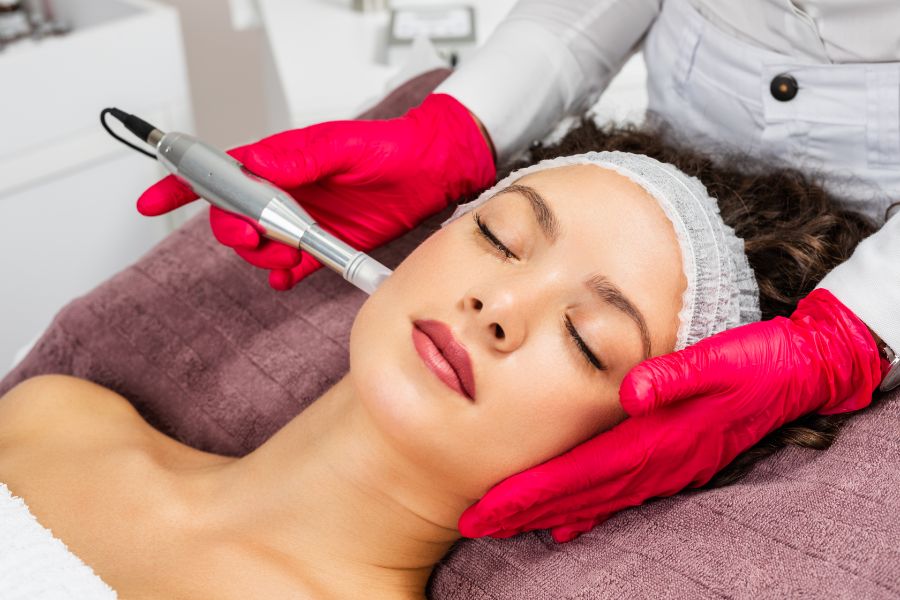 Single-use microneedling cartridge prepared for a Leeds treatment