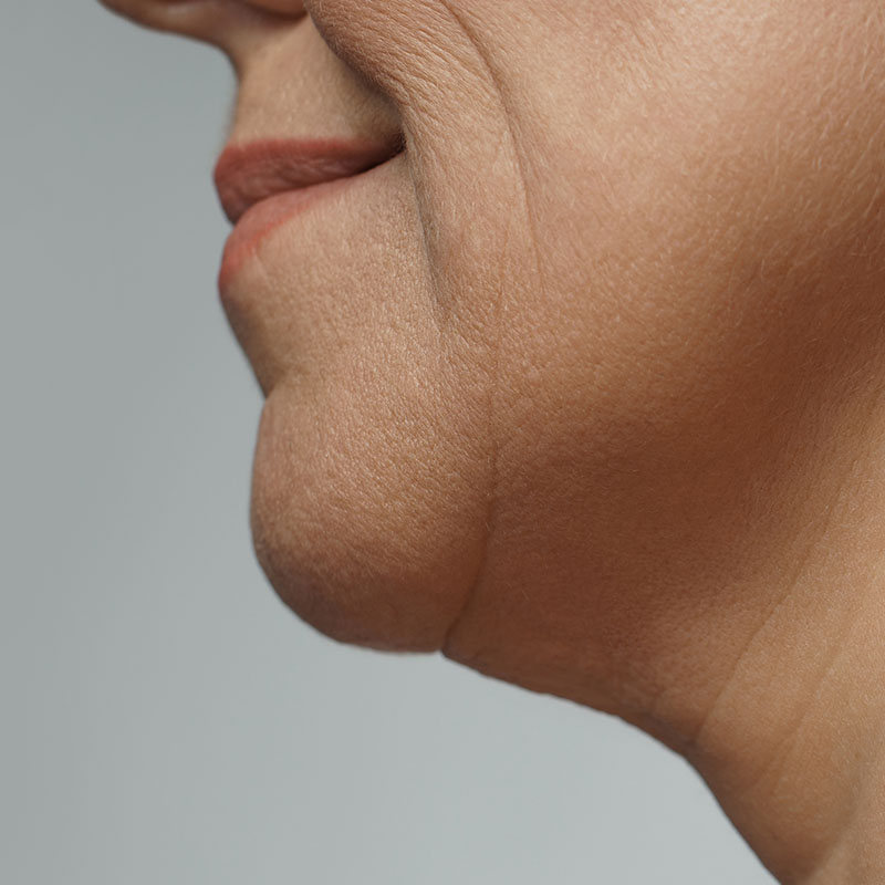 A man's chin and jawline in profile