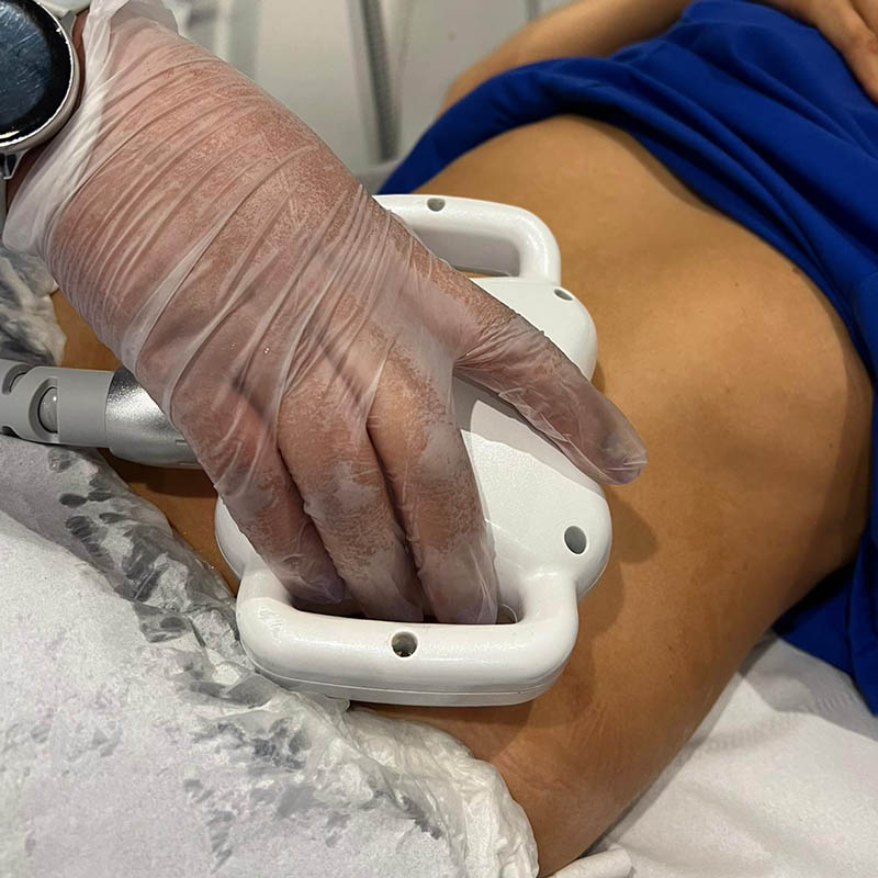 Practitioner using an ultrasound cavitation transducer on a selected Leeds treatment area